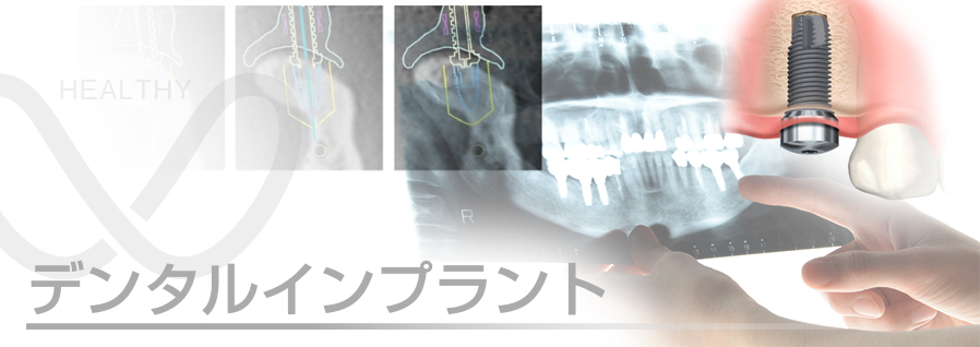 相馬郡新地町渡辺病院のデンタルインプラント